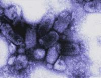 rabies virus